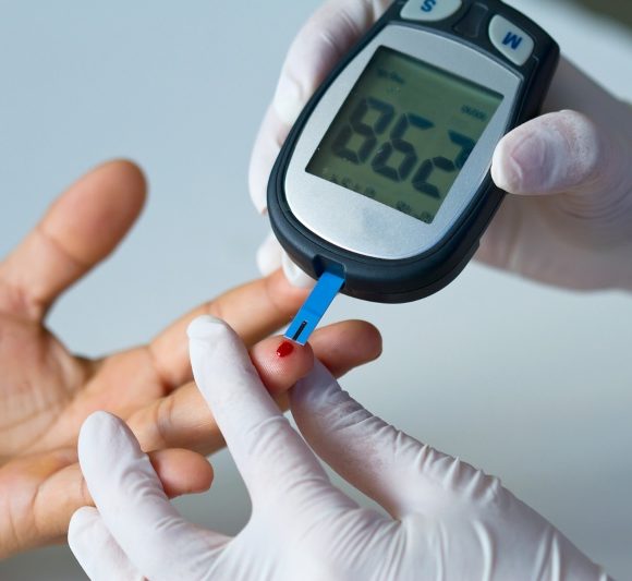 Glucemia Capilar: ¿Qué es y por qué es importante en la diabetes?